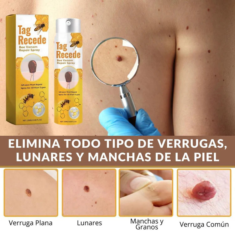 Tag Recede Eliminador de verrugas