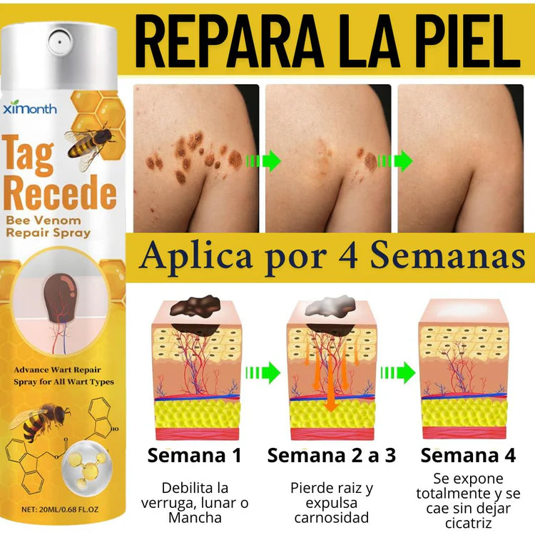 Tag Recede Eliminador de verrugas