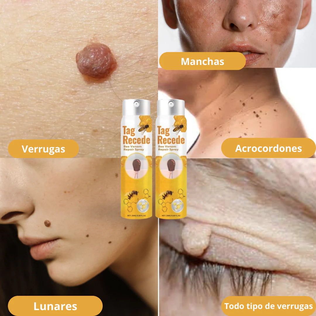 Tag Recede Eliminador de verrugas